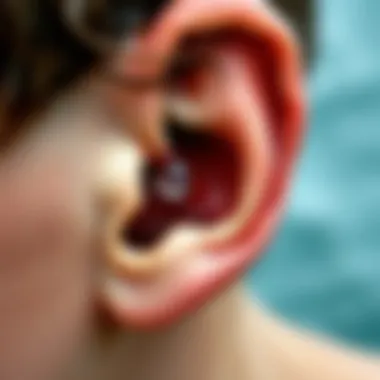 Anatomy of Ear Water Accumulation Anatomy of the ear showing water accumulation area